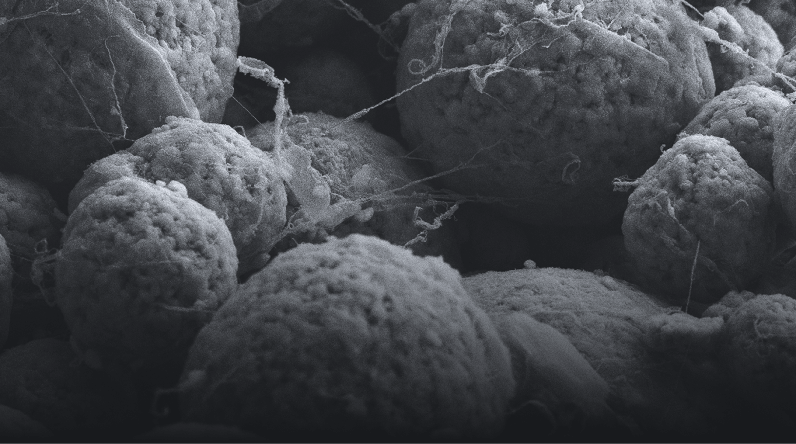 Dry battery electrodes